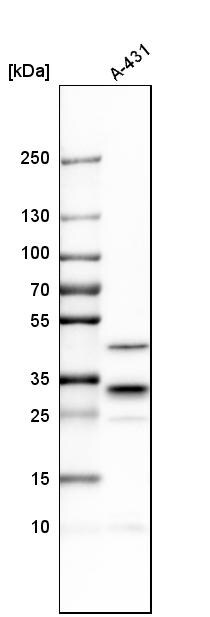 CAPZB Antibody - BSA Free Western Blot: CAPZB Antibody - BSA Free [NBP1-85922]