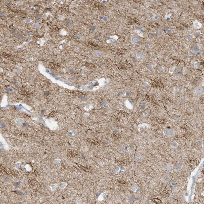 GTPBP2 Antibody - BSA Free Immunohistochemistry-Paraffin: GTPBP2 Antibody [NBP1-85924]