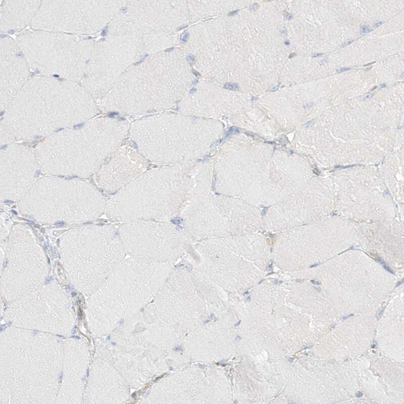 PGD Antibody - BSA Free Immunohistochemistry-Paraffin: PGD Antibody [NBP1-85925]