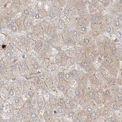 PGD Antibody - BSA Free Immunohistochemistry-Paraffin: PGD Antibody [NBP1-85925]