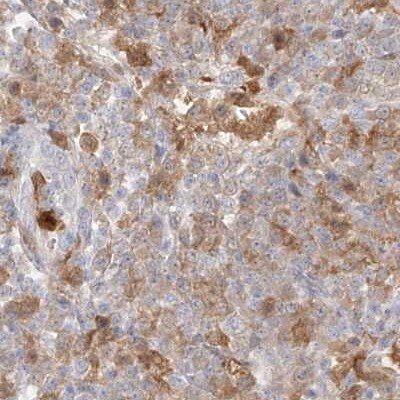 PGD Antibody - BSA Free Immunohistochemistry-Paraffin: PGD Antibody [NBP1-85925]