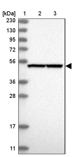 PGD Antibody - BSA Free Western Blot: PGD Antibody - BSA Free [NBP1-85925]
