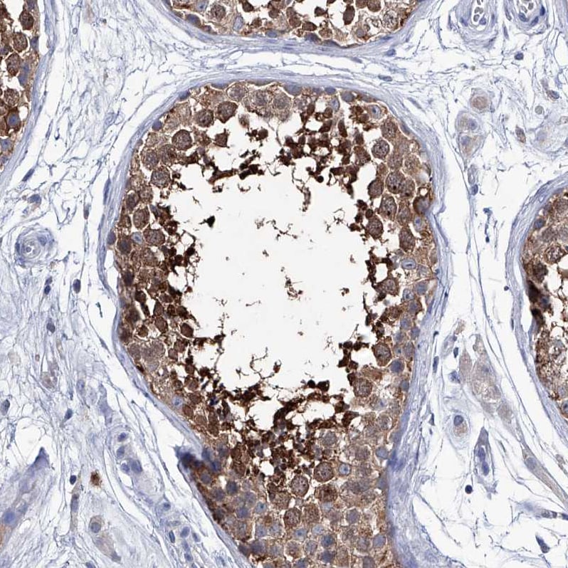 KLHL17 Antibody - BSA Free Immunohistochemistry-Paraffin: KLHL17 Antibody - BSA Free [NBP1-85926]