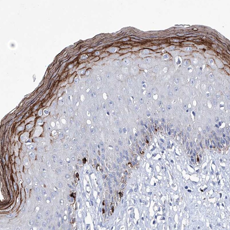KLHL17 Antibody - BSA Free Immunohistochemistry-Paraffin: KLHL17 Antibody - BSA Free [NBP1-85926]