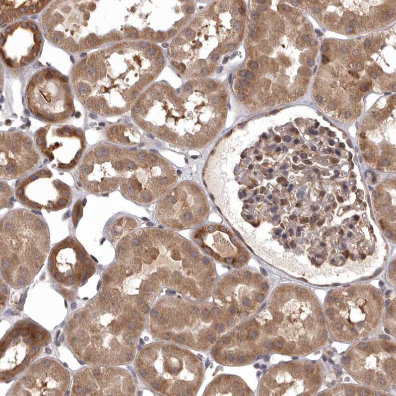 DARS Antibody - BSA Free Immunohistochemistry-Paraffin: DARS Antibody - BSA Free [NBP1-85937]