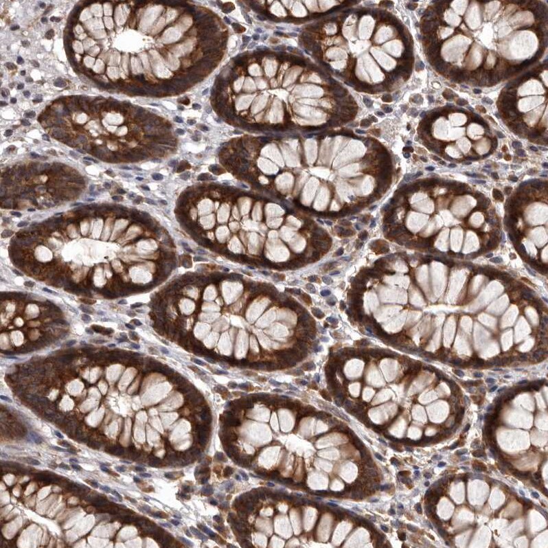 DARS Antibody - BSA Free Immunohistochemistry-Paraffin: DARS Antibody - BSA Free [NBP1-85937]