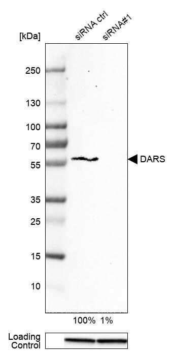 DARS Antibody - BSA Free Western Blot: DARS Antibody - BSA Free [NBP1-85937]