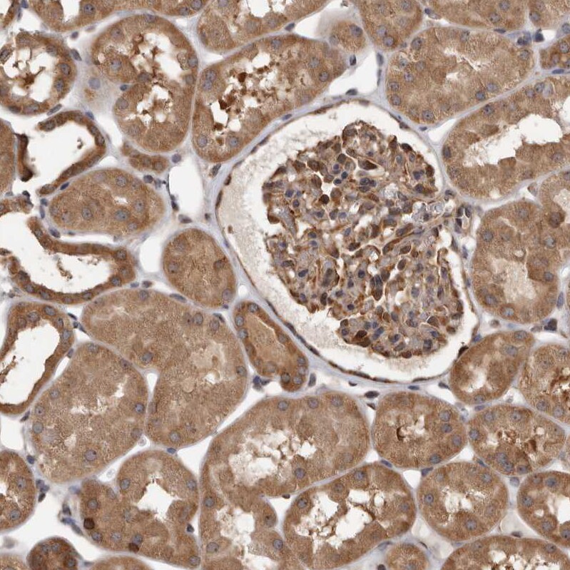 DARS Antibody - BSA Free Immunohistochemistry-Paraffin: DARS Antibody - BSA Free [NBP1-85938]