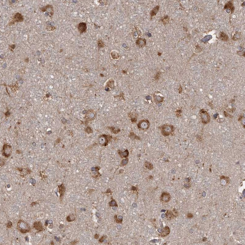 DARS Antibody - BSA Free Immunohistochemistry-Paraffin: DARS Antibody - BSA Free [NBP1-85938]