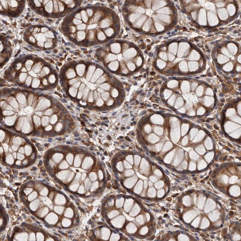 DARS Antibody - BSA Free Immunohistochemistry-Paraffin: DARS Antibody - BSA Free [NBP1-85938]