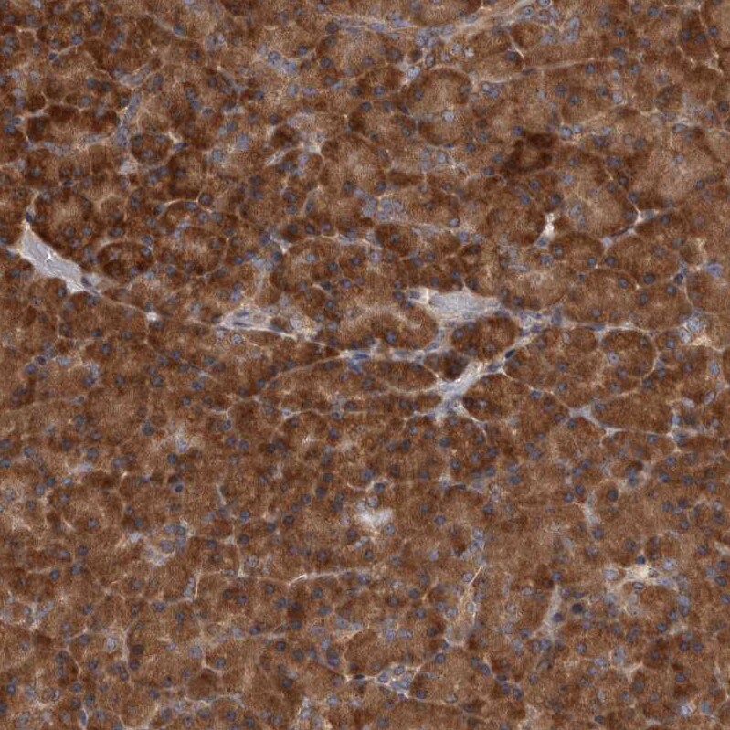 DARS Antibody - BSA Free Immunohistochemistry-Paraffin: DARS Antibody - BSA Free [NBP1-85938]