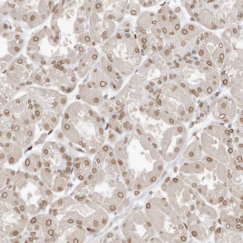 eIF5A2 Antibody - BSA Free Immunohistochemistry-Paraffin: eIF5A2 Antibody [NBP1-85943]