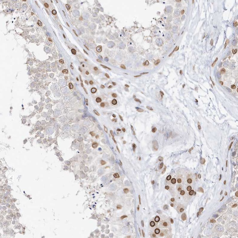 eIF5A2 Antibody - BSA Free Immunohistochemistry-Paraffin: eIF5A2 Antibody [NBP1-85943]