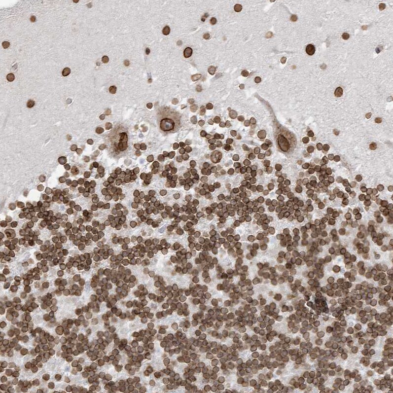 eIF5A2 Antibody - BSA Free Immunohistochemistry-Paraffin: eIF5A2 Antibody [NBP1-85943]