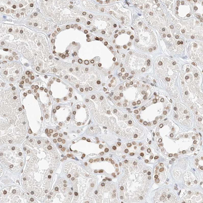 eIF5A2 Antibody - BSA Free Immunohistochemistry-Paraffin: eIF5A2 Antibody [NBP1-85943]