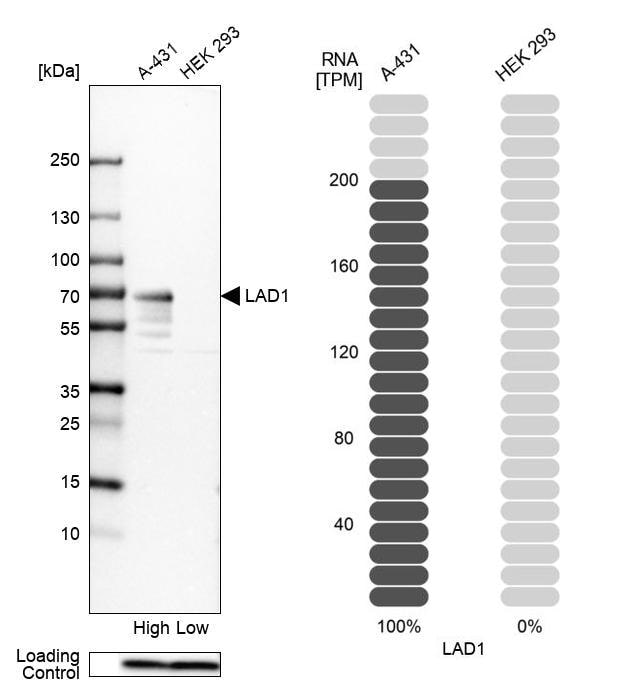 LAD1 Antibody - BSA Free Western Blot: LAD1 Antibody - BSA Free [NBP1-85945]