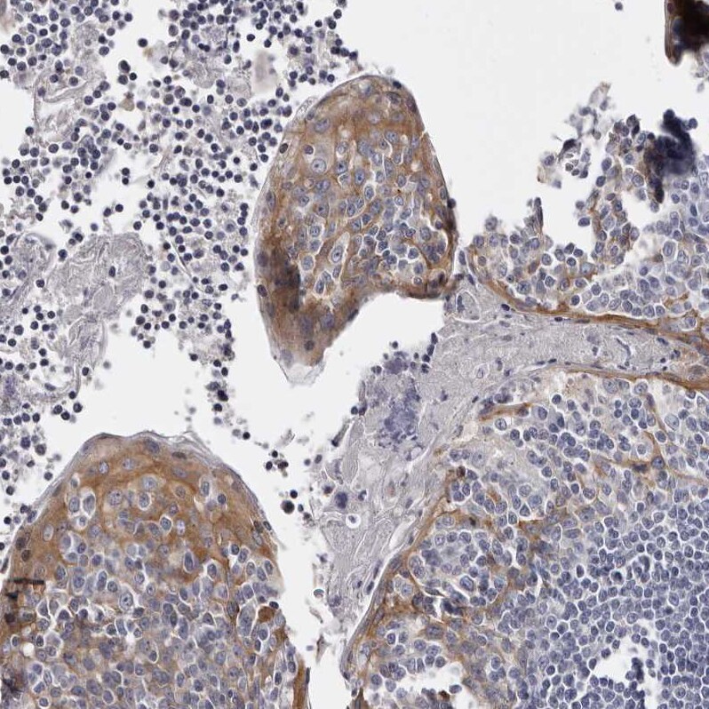 LAD1 Antibody - BSA Free Immunohistochemistry-Paraffin: LAD1 Antibody - BSA Free [NBP1-85945]