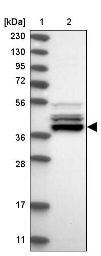 UROD Antibody - BSA Free Western Blot: UROD Antibody - BSA Free [NBP1-85946]