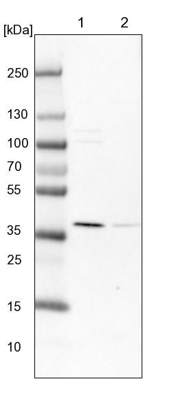 UROD Antibody - BSA Free Western Blot: UROD Antibody - BSA Free [NBP1-85946]