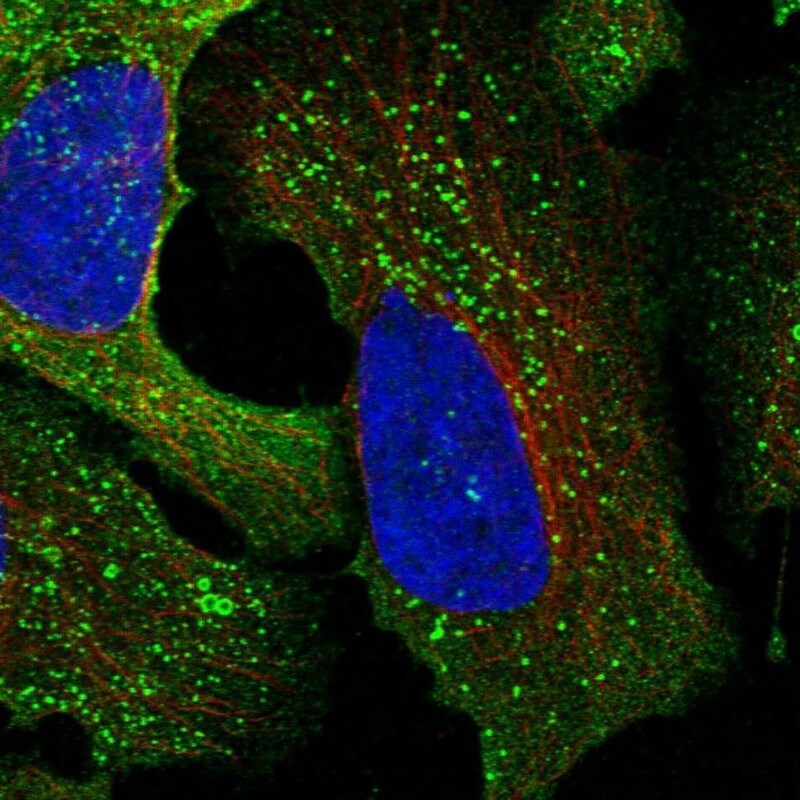 CSK Antibody - BSA Free Immunocytochemistry/ Immunofluorescence: CSK Antibody [NBP1-85951]
