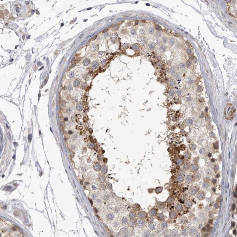 SSX2IP Antibody - BSA Free Immunohistochemistry-Paraffin: SSX2IP Antibody - BSA Free [NBP1-85956]