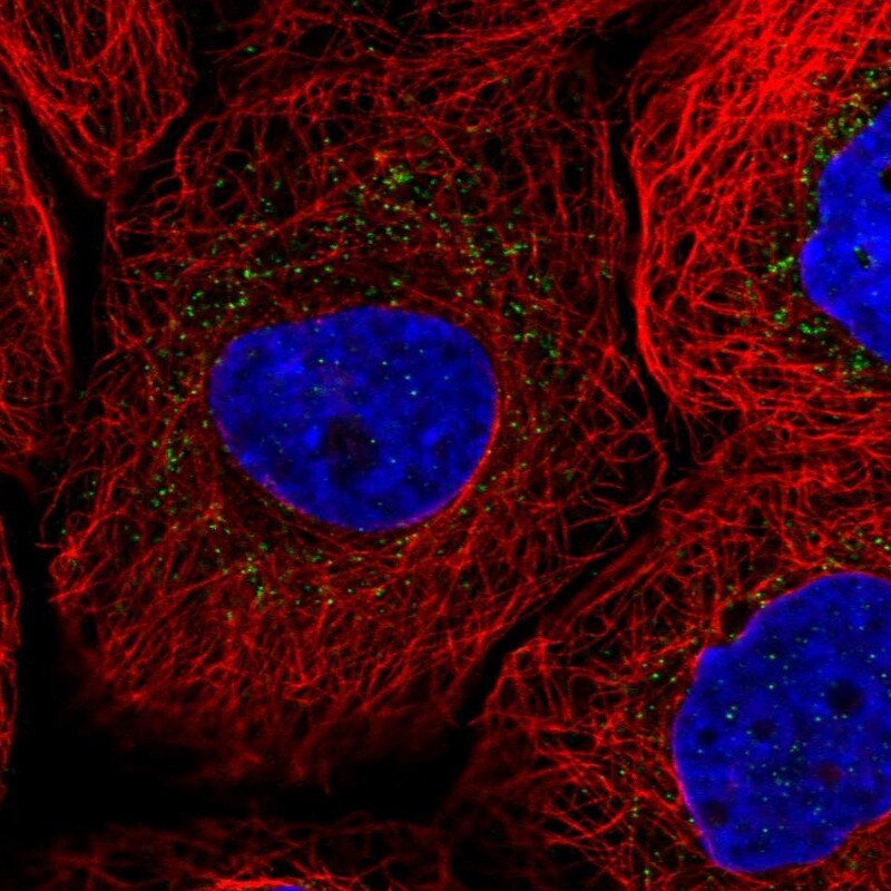 Sterol carrier protein 2 Antibody - BSA Free Immunocytochemistry/ Immunofluorescence: Sterol carrier protein 2 Antibody - BSA Free [NBP1-85958]
