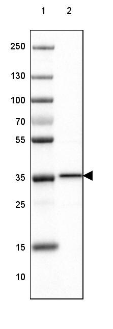 RABGGTB Antibody - BSA Free Western Blot: RABGGTB Antibody - BSA Free [NBP1-85962]