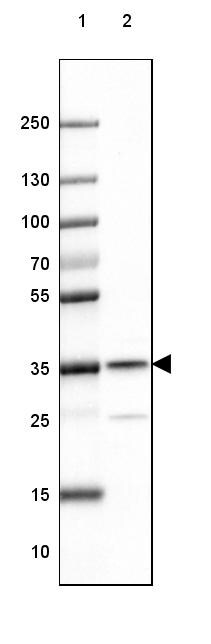 RABGGTB Antibody - BSA Free Western Blot: RABGGTB Antibody - BSA Free [NBP1-85962]
