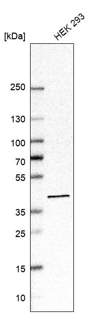 ACAT2 Antibody - BSA Free Western Blot: ACAT2 Antibody - BSA Free [NBP1-85967]