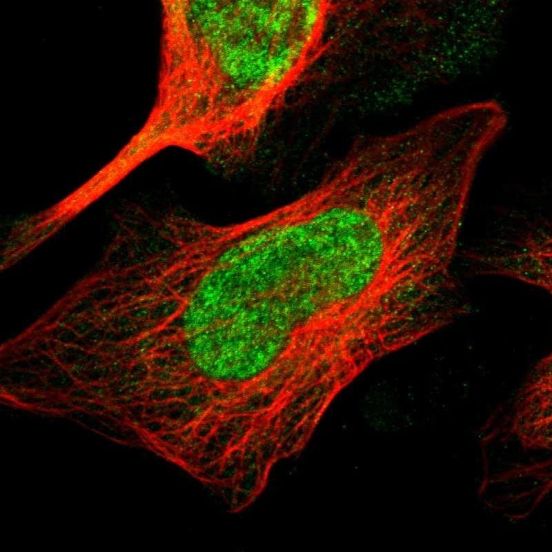 TMEM65 Antibody - BSA Free Immunocytochemistry/ Immunofluorescence: TMEM65 Antibody - BSA Free [NBP1-85970]