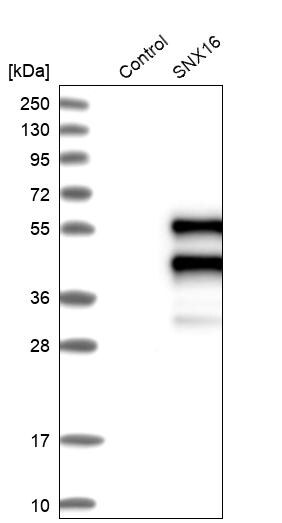 SNX16 Antibody - BSA Free Western Blot: SNX16 Antibody - BSA Free [NBP1-85972]