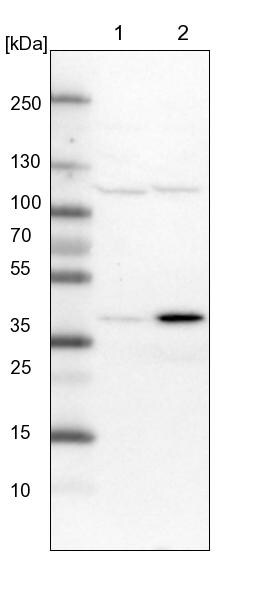SNX16 Antibody - BSA Free Western Blot: SNX16 Antibody - BSA Free [NBP1-85975]