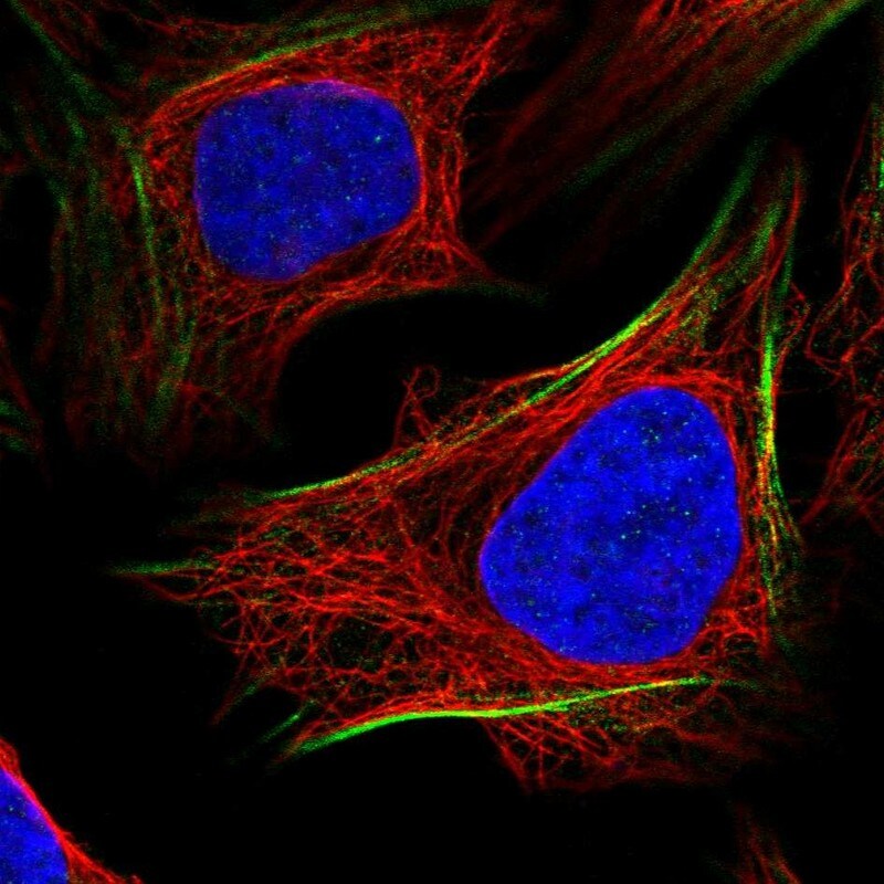 PGM1 Antibody - BSA Free Immunocytochemistry/ Immunofluorescence: PGM1 Antibody - BSA Free [NBP1-85977]