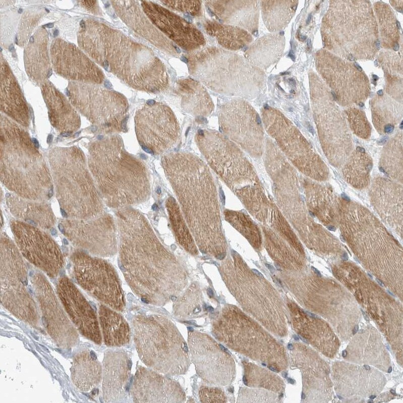 KIF1C Antibody - BSA Free Immunohistochemistry-Paraffin: KIF1C Antibody [NBP1-85978]
