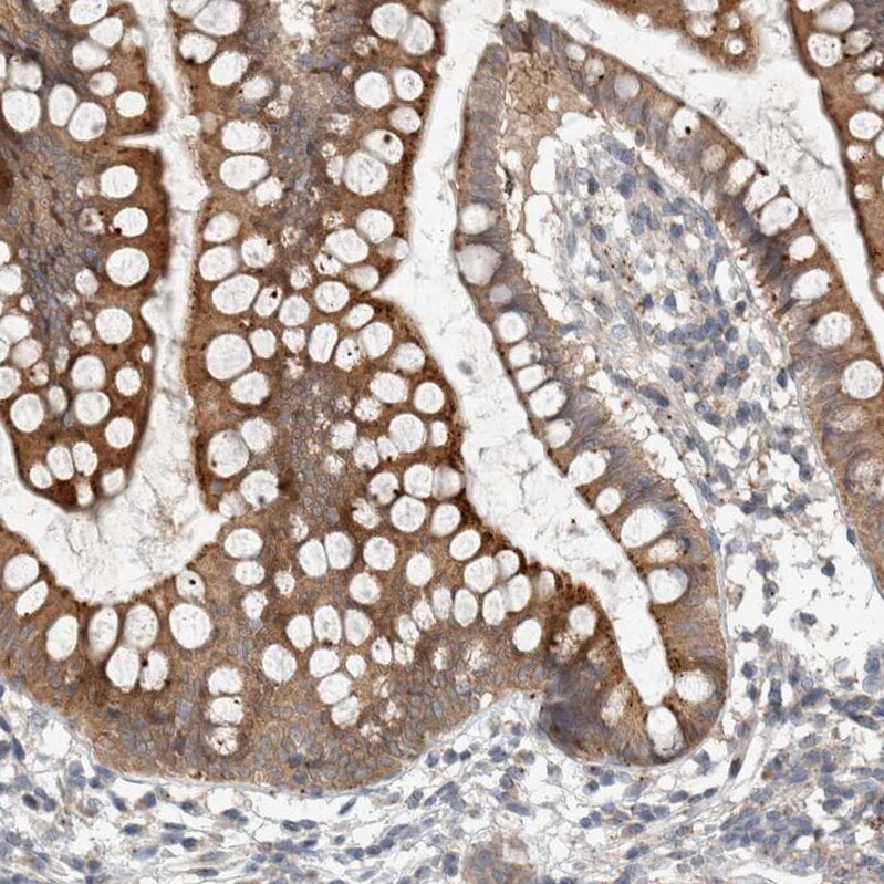 KIF1C Antibody - BSA Free Immunohistochemistry-Paraffin: KIF1C Antibody [NBP1-85978]