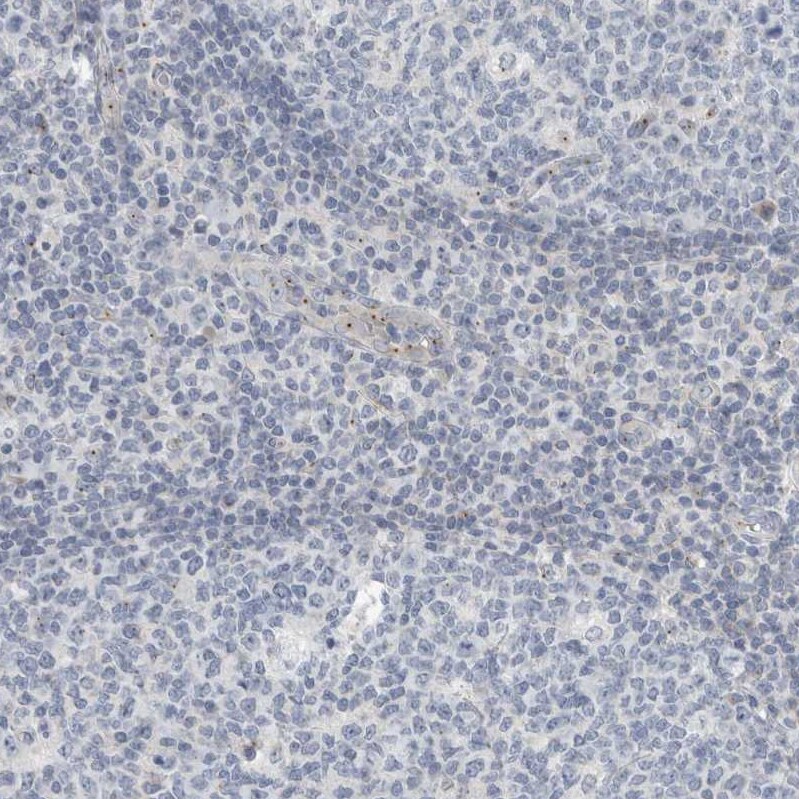 KIF1C Antibody - BSA Free Immunohistochemistry-Paraffin: KIF1C Antibody [NBP1-85978]