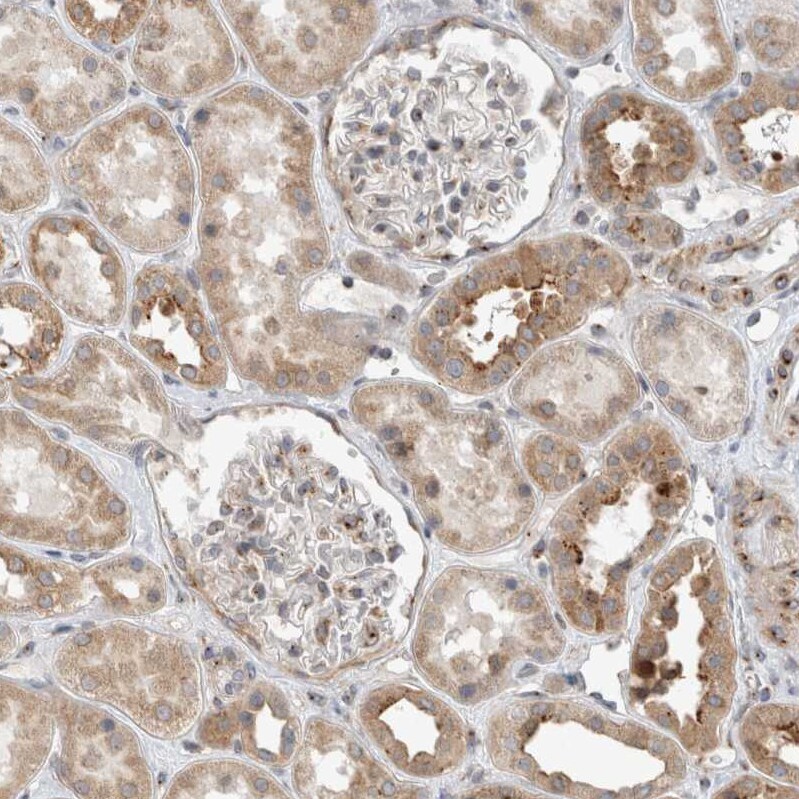 KIF1C Antibody - BSA Free Immunohistochemistry-Paraffin: KIF1C Antibody [NBP1-85978]