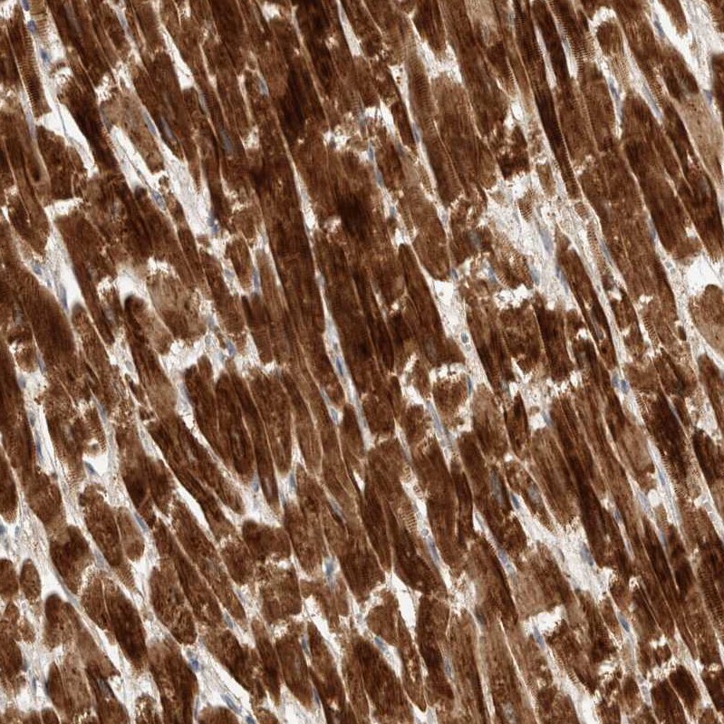 KIF1C Antibody - BSA Free Immunohistochemistry-Paraffin: KIF1C Antibody [NBP1-85978]