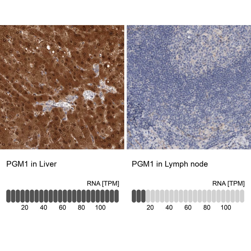 PGM1 Antibody - BSA Free Immunohistochemistry-Paraffin: PGM1 Antibody - BSA Free [NBP1-85982]
