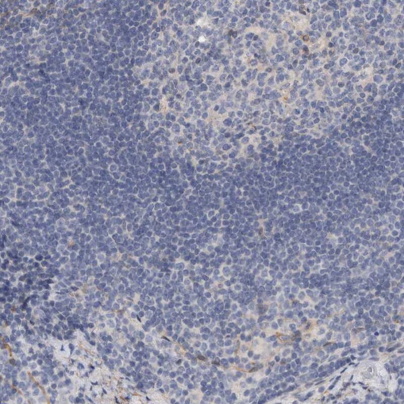 PGM1 Antibody - BSA Free Immunohistochemistry-Paraffin: PGM1 Antibody - BSA Free [NBP1-85982]