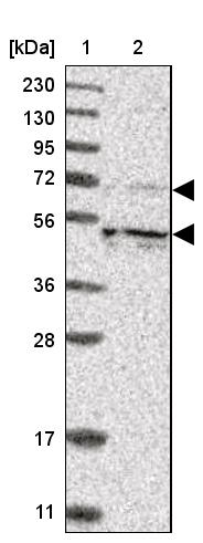 KIF12 Antibody - BSA Free Western Blot: KIF12 Antibody - BSA Free [NBP1-85984]