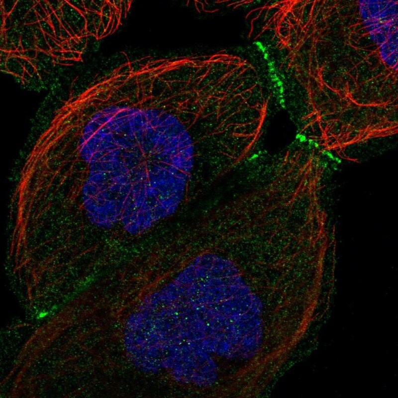 LMCD1 Antibody - BSA Free Immunocytochemistry/ Immunofluorescence: LMCD1 Antibody [NBP1-85986]