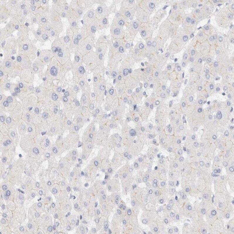 LMCD1 Antibody - BSA Free Immunohistochemistry-Paraffin: LMCD1 Antibody - BSA Free [NBP1-85986]