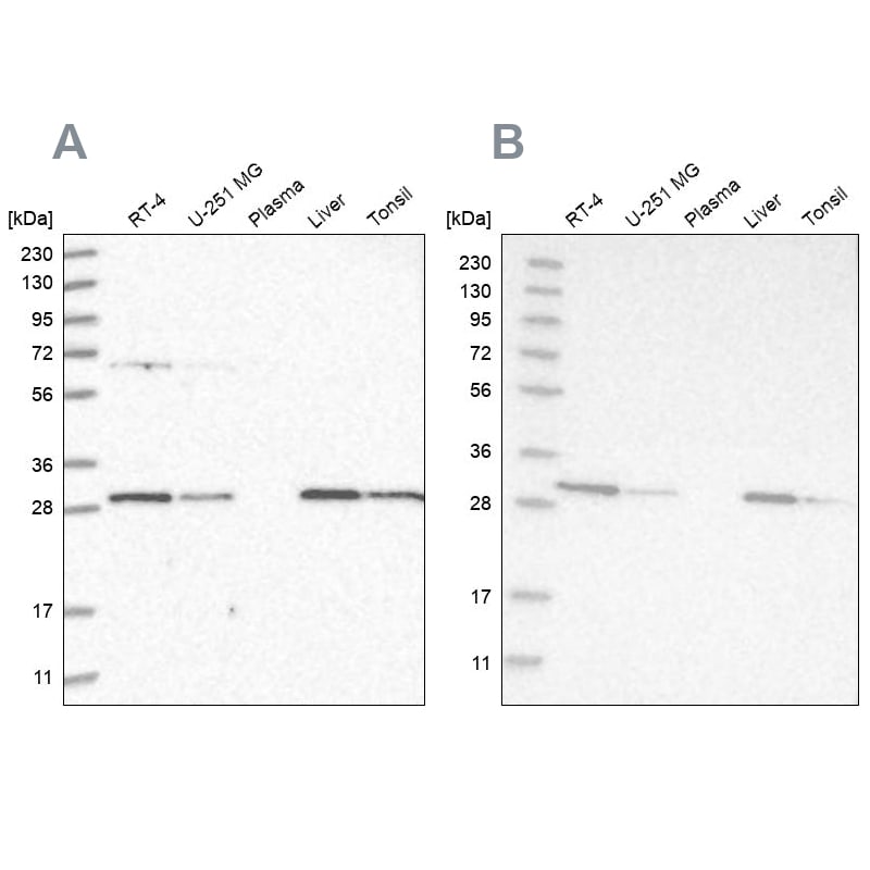PROSC Antibody - BSA Free Western Blot: PROSC Antibody - BSA Free [NBP1-85989]