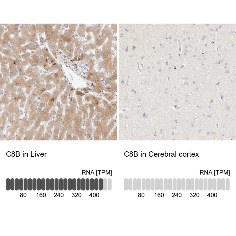 C8B Antibody - BSA Free Immunohistochemistry-Paraffin: C8B Antibody [NBP1-85990]