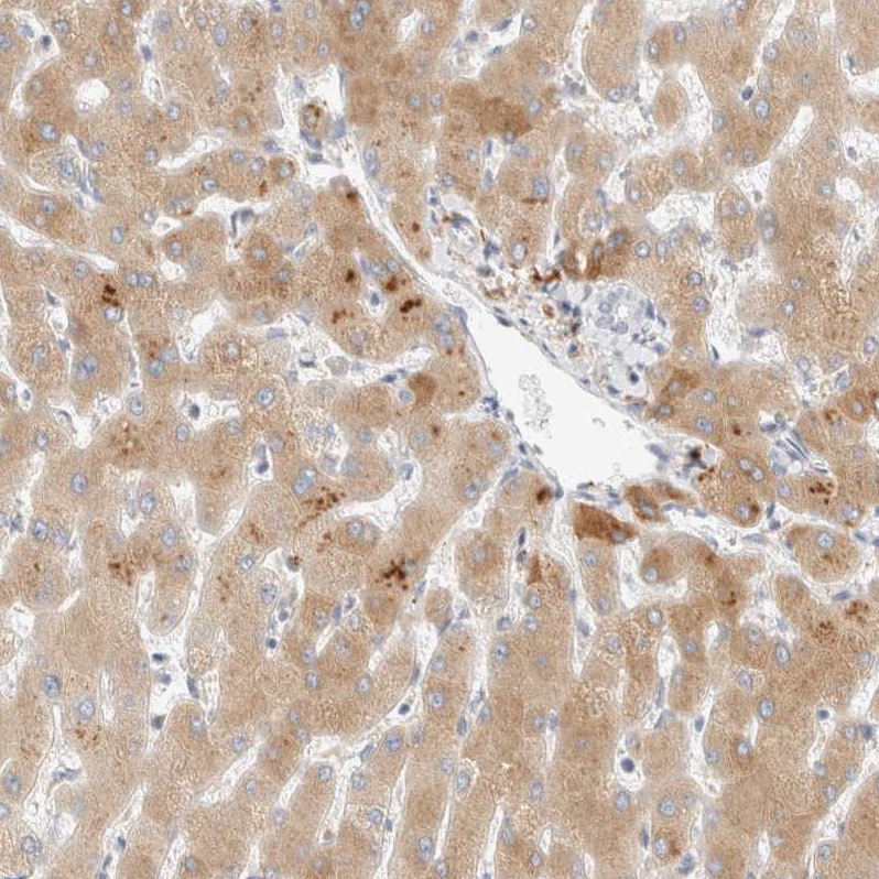 C8B Antibody - BSA Free Immunohistochemistry-Paraffin: C8B Antibody [NBP1-85990]