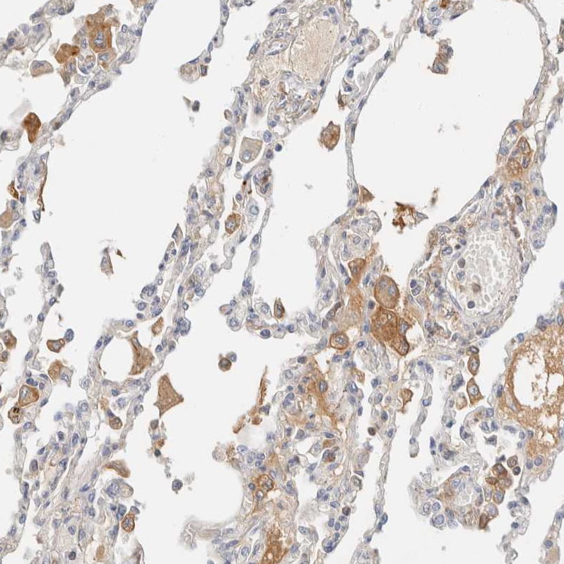 C8B Antibody - BSA Free Immunohistochemistry-Paraffin: C8B Antibody [NBP1-85990]