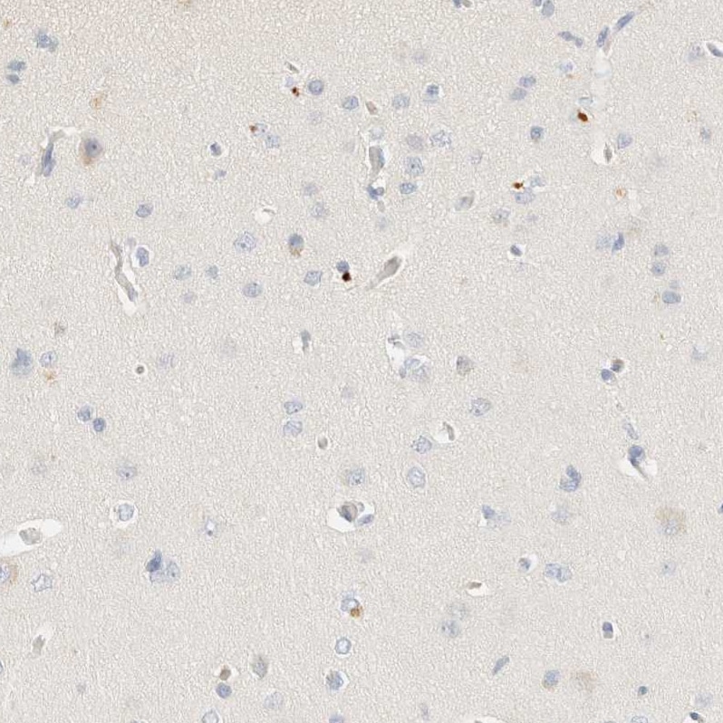 C8B Antibody - BSA Free Immunohistochemistry-Paraffin: C8B Antibody [NBP1-85990]