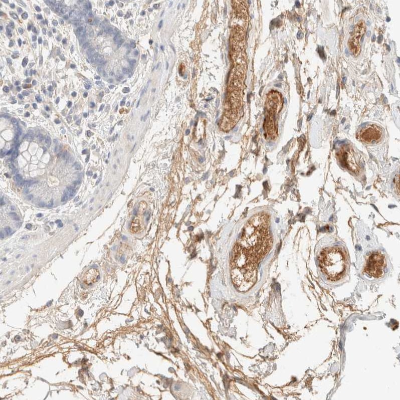C8B Antibody - BSA Free Immunohistochemistry-Paraffin: C8B Antibody [NBP1-85990]