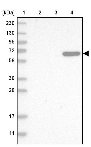 C8B Antibody - BSA Free Western Blot: C8B Antibody - BSA Free [NBP1-85990]
